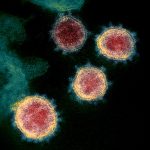Le virus SARS-CoV, tel que vu par un microscope électronique du National Institute of Allergy and Infectious Diseases (NIAID) des États-Unis. Image partagée sous licence Creative Commons Attribution 2.0 Générique (CC BY 2.0)